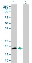 Anti-CSF3 Rabbit Polyclonal Antibody