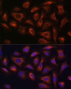 Anti-ARF GAP 2 antibody