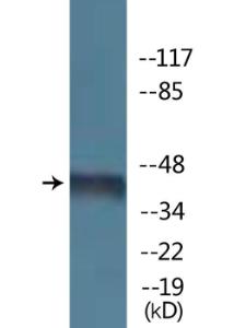 Western blot analysis of lysates from HeLa cells using Anti-Kir62 (phospho Thr224) Antibody