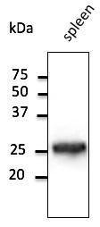 Spleen lysate detected with Anti-RAB5 Antibody at a 1:1,000 dilution Lysate at 100 µg and rabbit anti-goat IgG antibody (HRP) at a 1:10,000 dilution