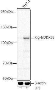 Western blot analysis of various lysates, using Anti-RIG-I/DDX58 Antibody [ARC54110] (A305884) at 1:2,000 dilution. THP-1 cells were treated by PMA/TPA (80 nM) at 37°C for overnight and LPS (1 µg/ml) at 37°C for 6 hours