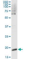 Anti-CSF3 Mouse Monoclonal Antibody [clone: 2C5]