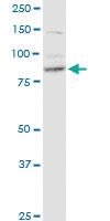 Anti-RRM1 Mouse Monoclonal Antibody [clone: 1D6]