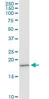 Anti-EIF1AY Mouse Monoclonal Antibody [clone: 1B4]