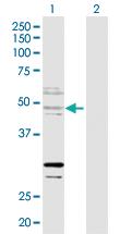 Anti-ZNF277 Rabbit Polyclonal Antibody