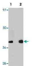 Anti-GATA3 Rabbit Polyclonal Antibody