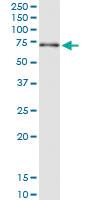 Anti-NPLOC4 Polyclonal Antibody Pair