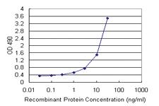 Anti-IL1RN Polyclonal Antibody Pair