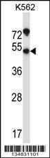 Anti-MAPKAPK3 Rabbit Polyclonal Antibody (FITC (Fluorescein Isothiocyanate))