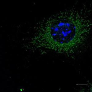 B6-RPE07 cells, fixed with 4% PFA, stained with Anti-RAB5 Antibody at a 1:50 dilution