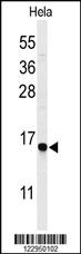 Anti-HTR1B Rabbit Polyclonal Antibody