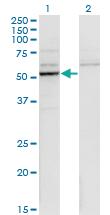 Anti-CYP26B1 Mouse Monoclonal Antibody [clone: 1H6]