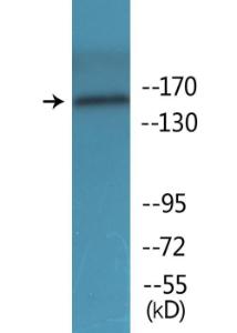 Anti-FANCA Rabbit Polyclonal Antibody