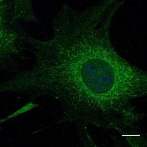 B6-RPE07 cells, fixed with 4% PFA, stained with Anti-RAB5 Antibody at a 1:50 dilution