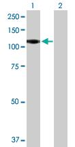 Anti-CSF3R Mouse Polyclonal Antibody