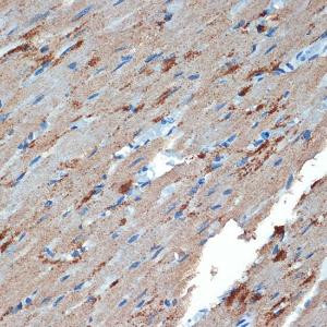 Immunohistochemistry analysis of paraffin-embedded rat heart using Anti-Creatine Kinase MB Antibody [ARC1990] (A307604) at a dilution of 1:100 (40X lens). Perform microwave antigen retrieval with 10 mM Tris/EDTA buffer pH 9.0 before commencing with IHC staining protocol