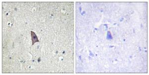 Immunohistochemical analysis of paraffin-embedded human brain using Anti-TIE2 (phospho Tyr1102) Antibody The right hand panel represents a negative control, where the antibody was pre-incubated with the immunising peptide