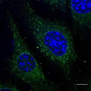 B6-RPE07 cells, fixed with 4% PFA, stained with Anti-RAB5 Antibody at a 1:50 dilution