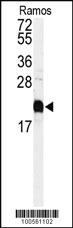 Anti-CALM1 Rabbit Polyclonal Antibody