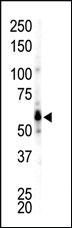 Anti-FGR Rabbit Polyclonal Antibody