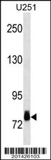 Anti-RPS6KA3 Mouse Monoclonal Antibody