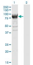 Anti-RRM1 Mouse Monoclonal Antibody [clone: 1D6]