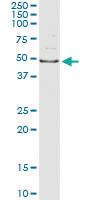 Anti-AIPL1 Antibody Pair