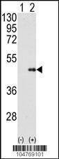 Anti-FNTB Rabbit Polyclonal Antibody (Biotin)