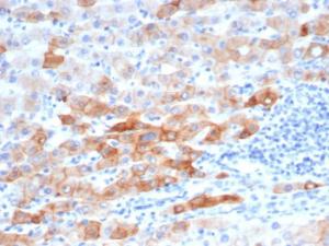 Anti-Cytokeratin 8 Mouse Recombinant Antibody [clone: rKRT8/6471]