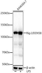 Western blot analysis of RAW264. 7, using Anti-RIG-I/DDX58 Antibody [ARC54110] (A305884) at 1:2,000 dilution. Raw264. 7 cells were treated by LPS (1 µg/ml) at 37°C for 8 hours. The secondary Antibody was Goat Anti-Rabbit IgG H&L Antibody (HRP) at 1:10000 dilution