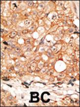 Anti-CALM1 Rabbit Polyclonal Antibody