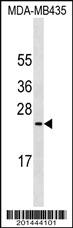 Anti-MUC1 Mouse Monoclonal Antibody