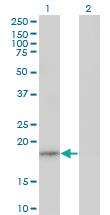 Anti-EIF1AY Mouse Monoclonal Antibody [clone: 1B4]