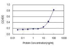 Anti-ACAT2 Polyclonal Antibody Pair