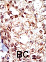 Anti-FGR Rabbit Polyclonal Antibody