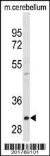 Anti-ZWINT Mouse Monoclonal Antibody