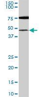 Anti-SMARCB1 Mouse Monoclonal Antibody [clone: 2H1]