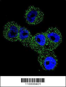 Anti-SERPINB5 Rabbit Polyclonal Antibody (Biotin)