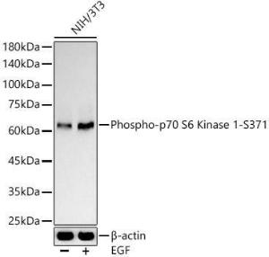 Anti-S6K1 Rabbit Polyclonal Antibody