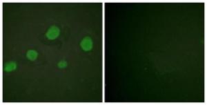 Immunofluorescence analysis of HUVEC cells using Anti-GATA3 (phospho Ser308) Antibody. The right hand panel represents a negative control, where the antibody was pre-incubated with the immunising peptide