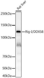 Western blot analysis of Rat liver, using Anti-RIG-I/DDX58 Antibody [ARC54108] (A305885) at 1:4,000 dilution The secondary antibody was Goat Anti-Rabbit IgG H&L Antibody (HRP) at 1:10,000 dilution Lysates/proteins were present at 25 µg per lane