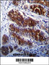 Anti-FRK Rabbit Polyclonal Antibody