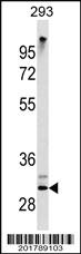 Anti-ZWINT Mouse Monoclonal Antibody