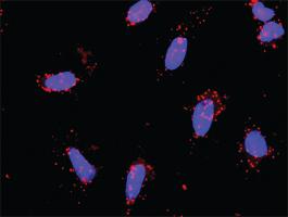 Anti-PDGFA + PLCG1 Antibody Pair