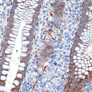 Immunohistochemistry analysis of paraffin-embedded human appendix tissue using Anti-Creatine Kinase MB Antibody [ARC1990] (A307604) at a dilution of 1:100 (40X lens). Perform microwave antigen retrieval with 10 mM Tris/EDTA buffer pH 9.0 before commencing with IHC staining protocol