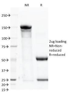 SDS-PAGE analysis of Anti-PSMA Antibody [FOLH1/2363] under non-reduced and reduced conditions; showing intact IgG and intact heavy and light chains, respectively SDS-PAGE analysis confirms the integrity and purity of the antibody