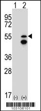 Anti-FRK Rabbit Polyclonal Antibody