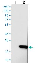 Anti-PDZD11 Rabbit Polyclonal Antibody