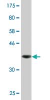 Anti-ABCG2 Mouse Monoclonal Antibody [clone: 1G1]