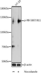 Western blot analysis of extracts of HT-29 cells, using Anti-Rb (phospho Ser807 + Ser811) Antibody (A10969) at 1:1000 dilution